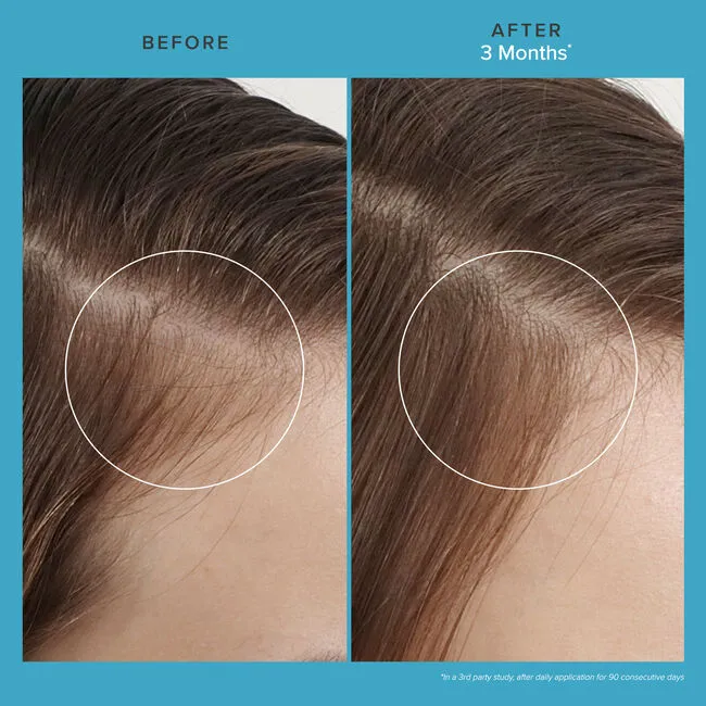 Living Proof Scalp Care Revitalizing Treatment